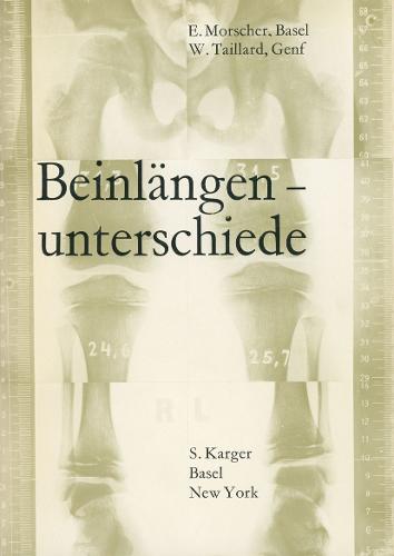 Die Beinlangenunterschiede