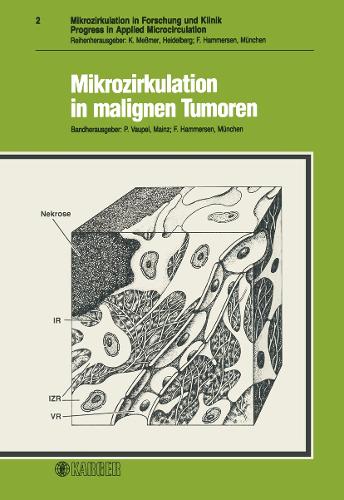 Mikrozirkulation in malignen Tumoren