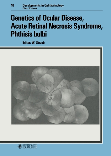 Genetics of Ocular Disease, Acute Retinal Necrosis Syndrome, Phthisis bulbi