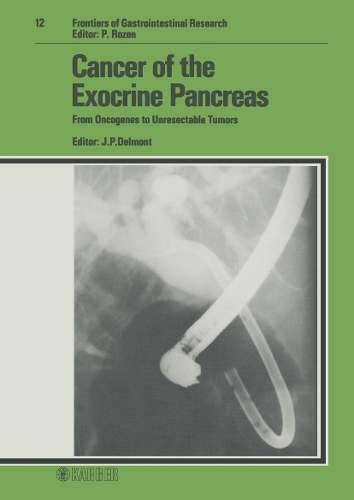 Cancer of the Exocrine Pancreas