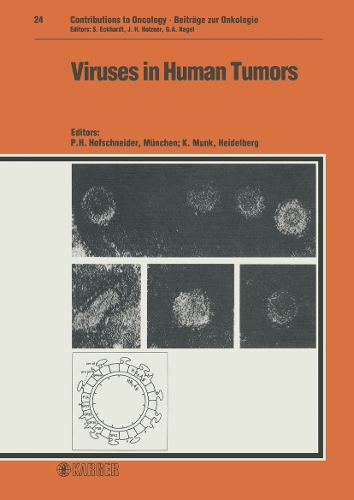 Viruses in Human Tumors