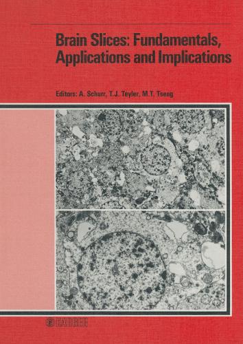 Brain Slices: Fundamentals, Applications and Implications