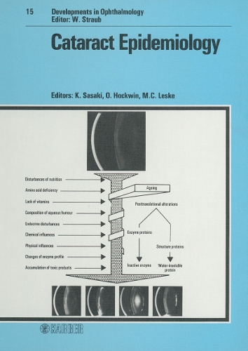 Cataract Epidemiology