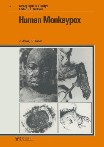 Human Monkeypox