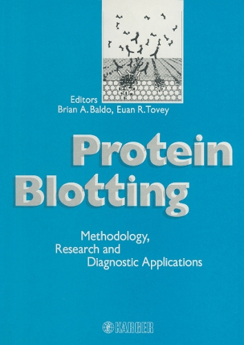 Protein Blotting