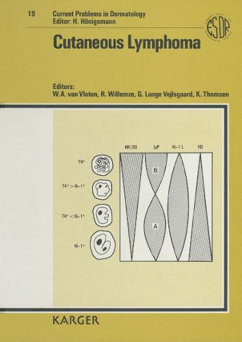 Cutaneous Lymphoma