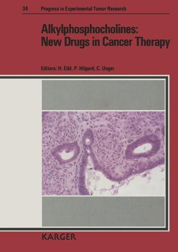 Alkylphosphocholines: New Drugs in Cancer Therapy