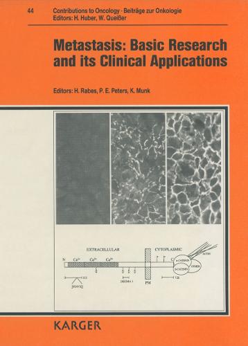 Metastasis: Basic Research and Its Clinical Applications