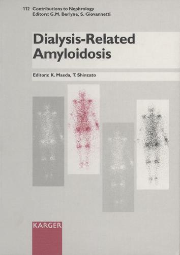 Dialysis-Related Amyloidosis