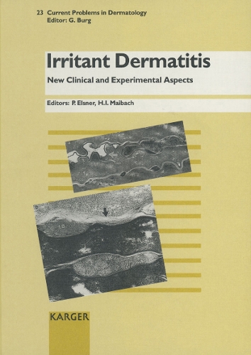 Irritant Dermatitis