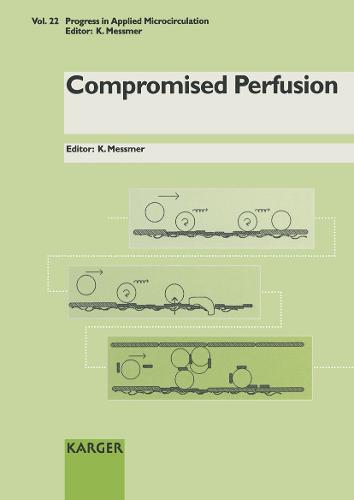 Compromised Perfusion