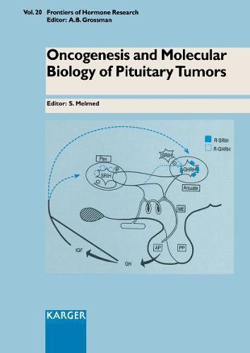 Oncogenesis and Molecular Biology of Pituitary Tumors
