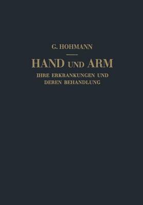Hand und Arm