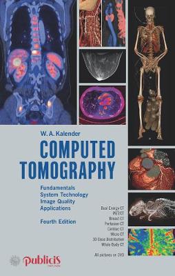 Computed Tomography