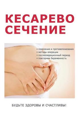 Кесарево сечение и все, что надо о нем знать