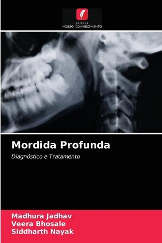 Mordida Profunda
