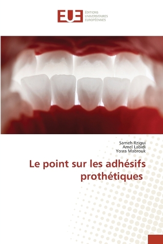 Le point sur les adhésifs prothétiques