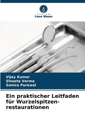 Ein praktischer Leitfaden für Wurzelspitzen- restaurationen