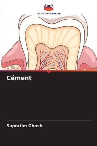 Cément