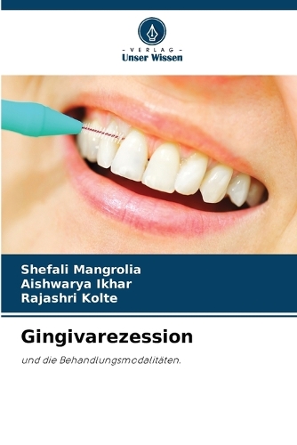 Gingivarezession