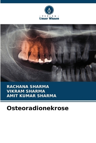 Osteoradionekrose
