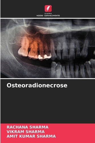 Osteoradionecrose