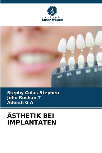 Ästhetik Bei Implantaten
