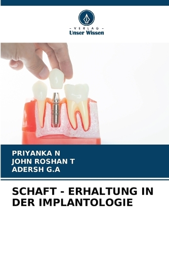 Schaft - Erhaltung in Der Implantologie