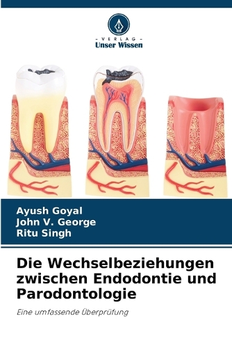 Die Wechselbeziehungen zwischen Endodontie und Parodontologie