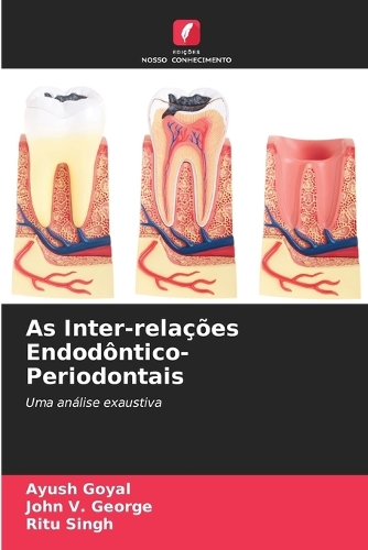 As Inter-relações Endodôntico-Periodontais