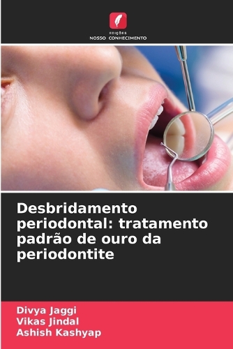 Desbridamento periodontal