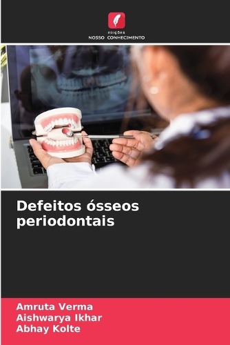 Defeitos ósseos periodontais