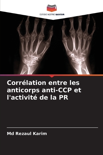 Corrélation entre les anticorps anti-CCP et l'activité de la PR