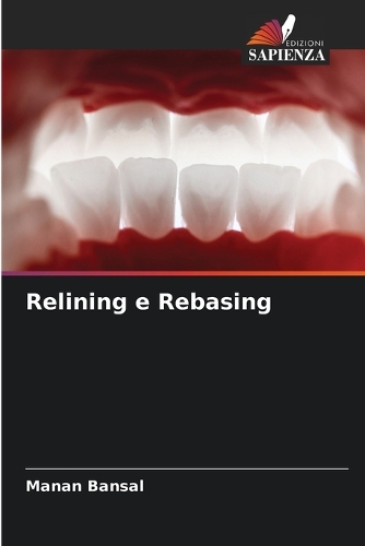 Relining e Rebasing