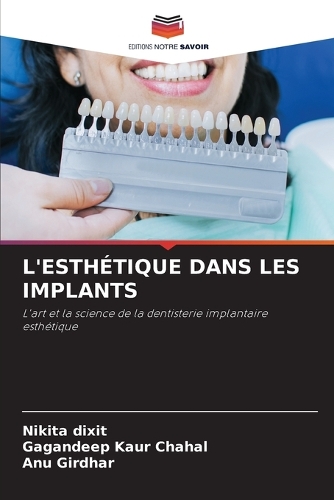 L'Esthétique Dans Les Implants