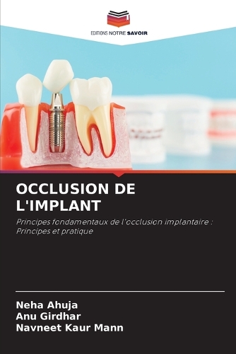Occlusion de l'Implant