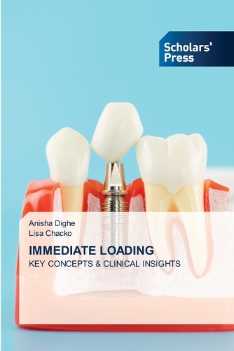 Immediate Loading