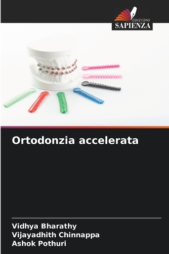 Ortodonzia accelerata