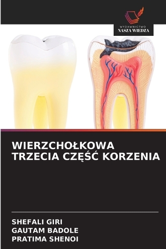 Wierzcholkowa Trzecia CzĘŚĆ Korzenia