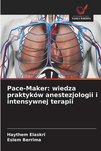 Pace-Maker