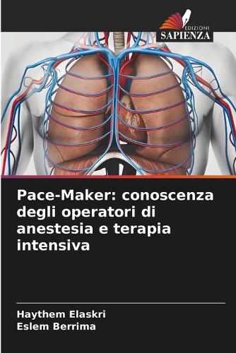 Pace-Maker