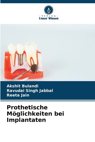 Prothetische Möglichkeiten bei Implantaten