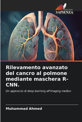 Rilevamento avanzato del cancro al polmone mediante maschera R-CNN.