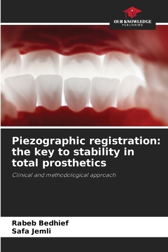 Piezographic registration
