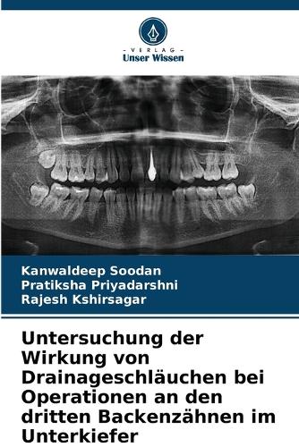 Untersuchung der Wirkung von Drainageschläuchen bei Operationen an den dritten Backenzähnen im Unterkiefer
