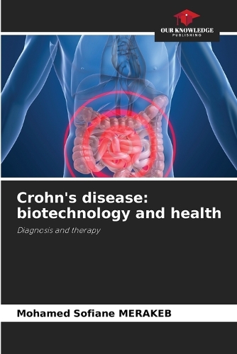 Crohn's disease