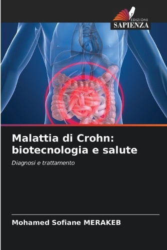 Malattia di Crohn