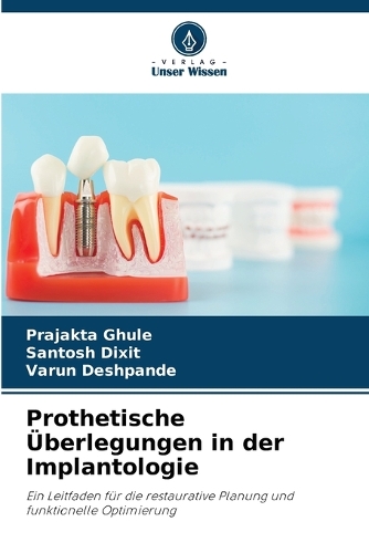 Prothetische Überlegungen in der Implantologie