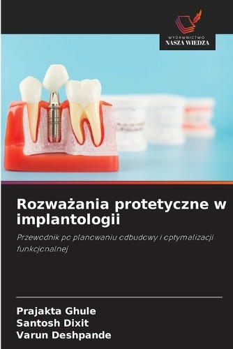 Rozważania protetyczne w implantologii