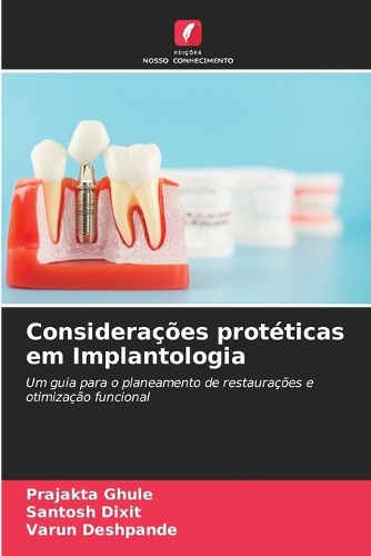 Considerações protéticas em Implantologia